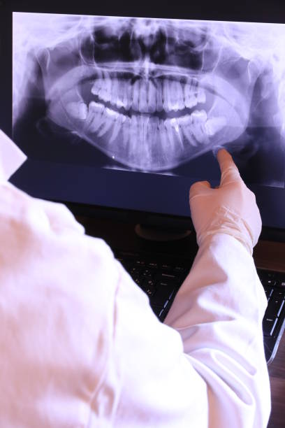 Best Broken or Cracked Tooth Emergency Dentist in Thatcher, UT